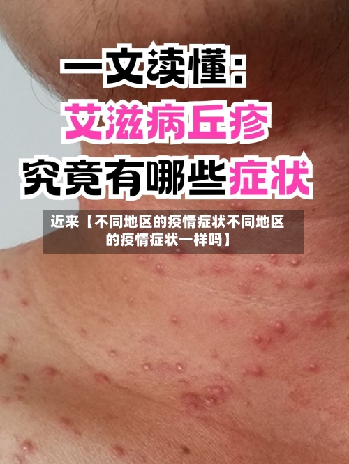 近来【不同地区的疫情症状不同地区的疫情症状一样吗】-第2张图片