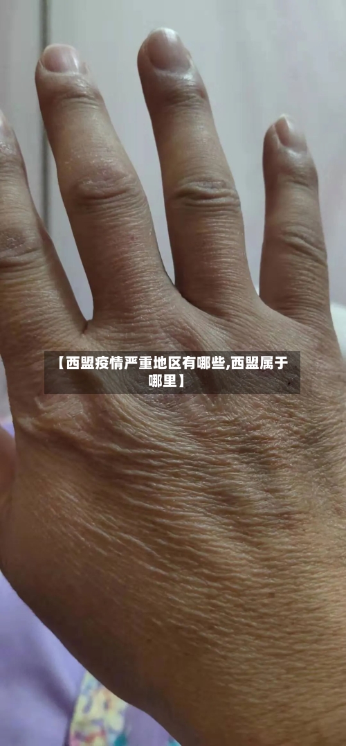 【西盟疫情严重地区有哪些,西盟属于哪里】-第3张图片